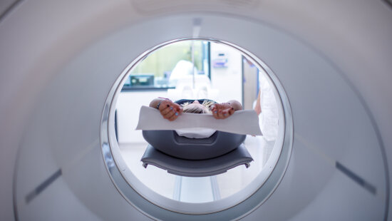 MOÚ je partnerem projektu pro výzkum vzácných druhů zhoubných nádorů